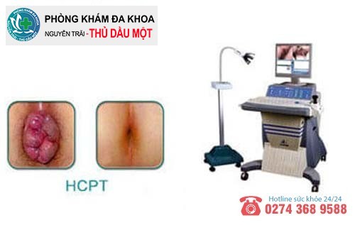 Phương pháp HCPT hỗ trợ điều trị sa búi hậu môn hiệu quả