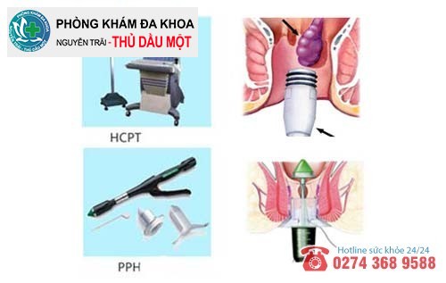 Hậu môn chảy mủ phải hỗ trợ điều trị như thế nào?