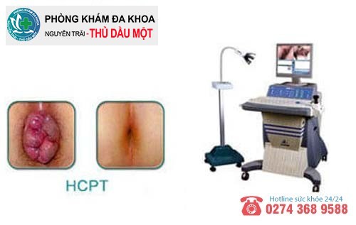 Phương pháp HCPT hay phẫu thuật xâm lấn tối thiểu HCTP