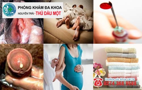 Đặc điểm của lậu cầu khuẩn