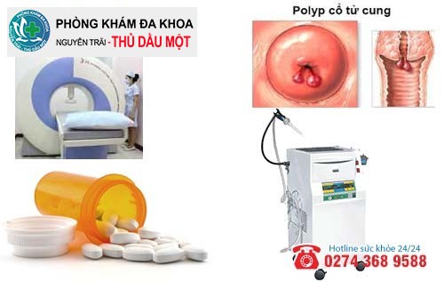 Cách hỗ trợ điều trị polyp cổ tử cung hiệu quả hiện nay