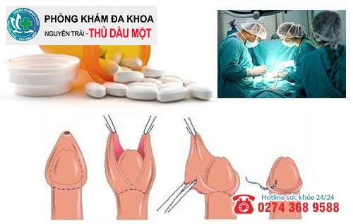 Phương pháp hỗ trợ điều trị nhiễm trùng dương vật