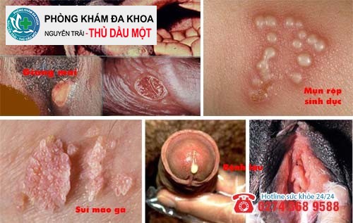 Đau buốt vùng kín có thể là dấu hiệu bệnh xã hội