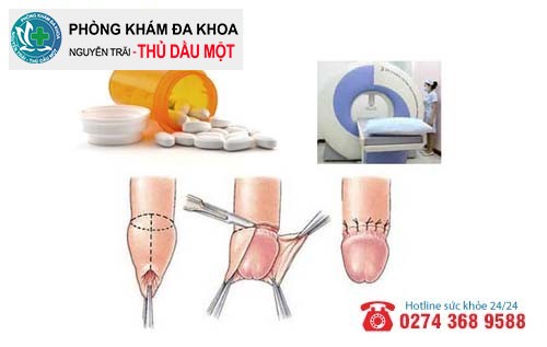 Cách hỗ trợ trị dương vật nổi mụn hiệu quả tại Đa khoa Nguyễn Trải - Thủ Dầu Một