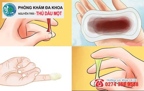 Khí hư như thế nào là bình thường?