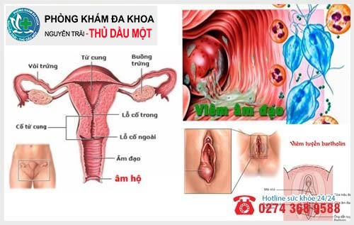 Những căn bệnh phụ khoa khiến môi lớn bị sưng và ngứa