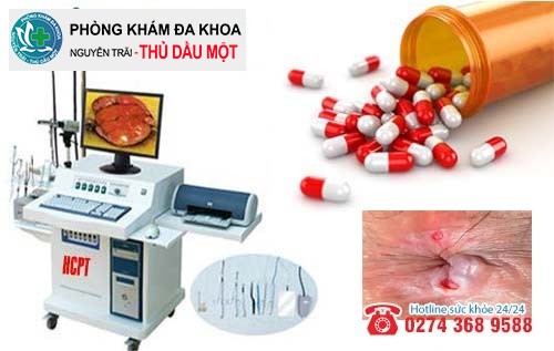 Phương pháp hỗ trợ trị loét hậu môn hiệu quả