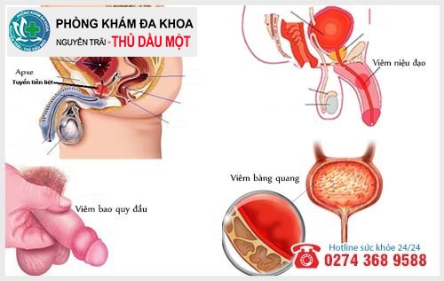 Nguyên nhân ra mủ ở đầu dương vật