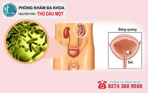 Nhiễm nấm đường tiết niệu là gì?