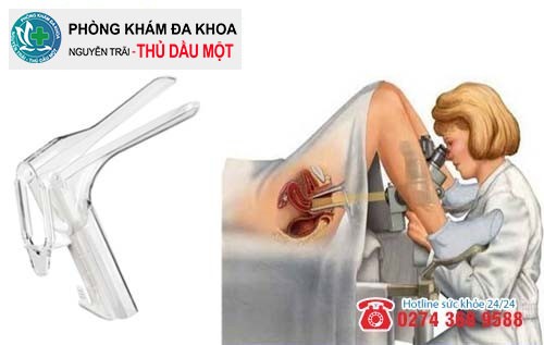 Đa khoa Thủ Dầu áp dụng mỏ vịt khám phụ khoa hiệu quả