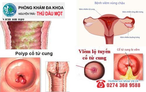 Tổng hợp một số bệnh phụ khoa chị em phụ nữ thường gặp