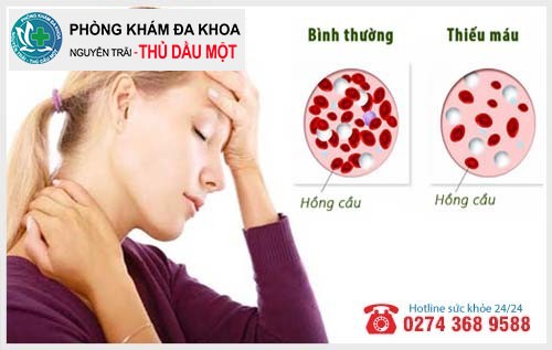 Tác hại u xơ tử cung nghiêm trọng