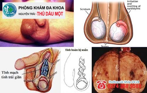 Trứng dái chảy mũ tình trạng nguy hiểm