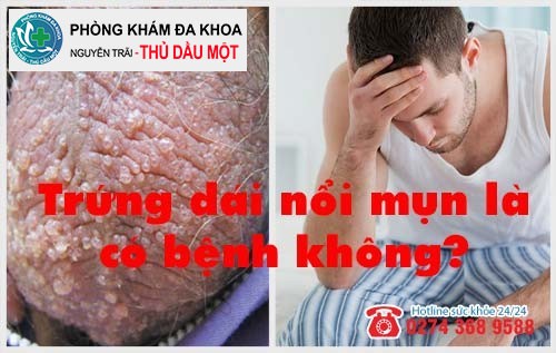 Trứng dái nổi mụn là có bệnh không?