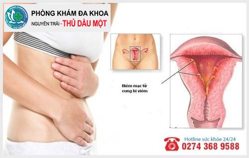 Viêm nội mạc tử cung