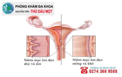 Viêm teo âm đạo là căn bệnh nguy hiểm 